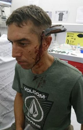 Բնակիչը հիվանդանոց է դիմել՝ դանակը գլխի մեջ. լուսանկար